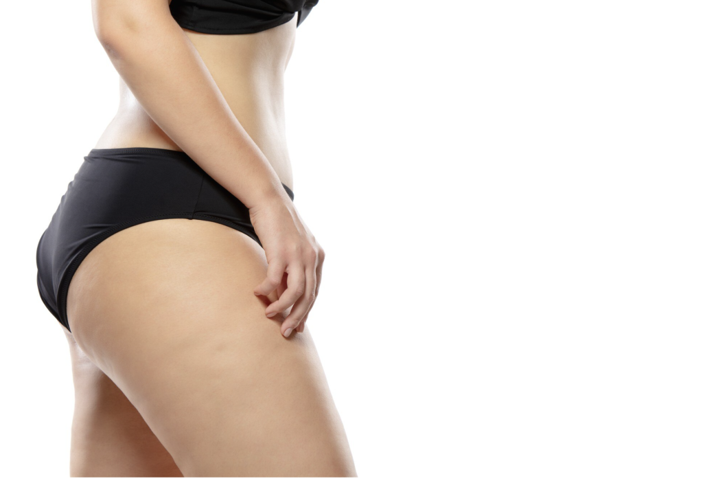 Tratamiento DPEF (“celulitis”)